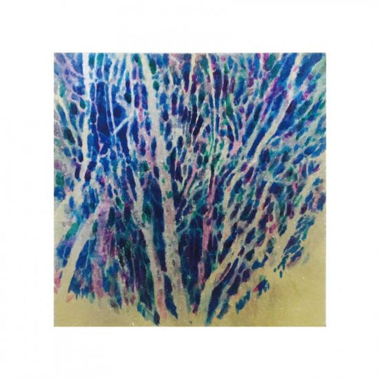 木漏れ日に覗かれる(2)(M)